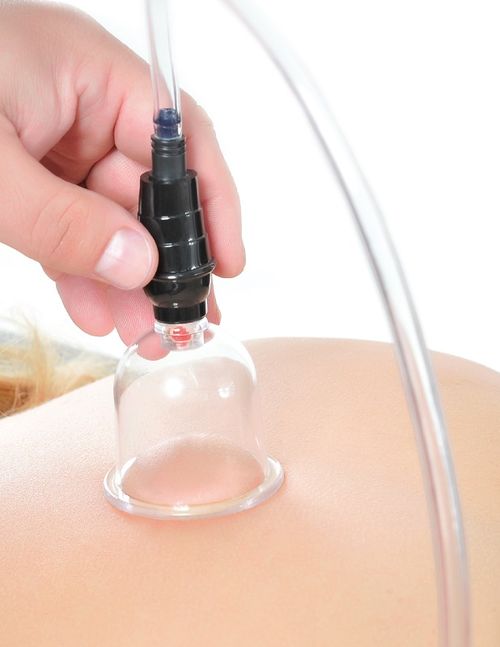 Fetish Fantasy Series - 6 Delars Cupping